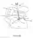 Fig. 72 - Systems for and methods of fusing a sacroiliac joint