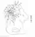 Fig. 75 - Systems for and methods of fusing a sacroiliac joint