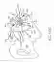 Fig. 91 - Systems for and methods of fusing a sacroiliac joint