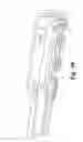 Fig. 22 - Expandable interbody fusion device