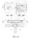 Fig. 33 - Flanged interbody fusion device with fastener insert and retaining ring