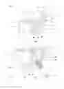 Fig. 02 - Spinal intervertebral implant