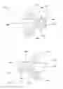 Fig. 07 - Spinal intervertebral implant
