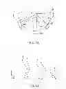 Fig. 02 - Systems and methods for providing deeper knee flexion capabilities for knee prosthesis patients