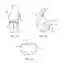 Fig. 03 - Systems and methods for providing deeper knee flexion capabilities for knee prosthesis patients