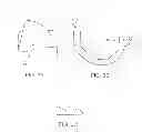 Fig. 04 - Systems and methods for providing deeper knee flexion capabilities for knee prosthesis patients