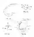 Fig. 05 - Systems and methods for providing deeper knee flexion capabilities for knee prosthesis patients