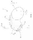Fig. 09 - Systems and methods for providing deeper knee flexion capabilities for knee prosthesis patients