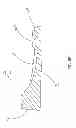 Fig. 10 - Systems and methods for providing deeper knee flexion capabilities for knee prosthesis patients
