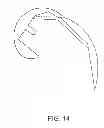 Fig. 23 - Systems and methods for providing deeper knee flexion capabilities for knee prosthesis patients