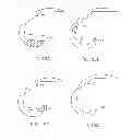 Fig. 24 - Systems and methods for providing deeper knee flexion capabilities for knee prosthesis patients