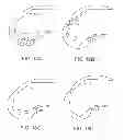Fig. 25 - Systems and methods for providing deeper knee flexion capabilities for knee prosthesis patients