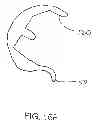 Fig. 27 - Systems and methods for providing deeper knee flexion capabilities for knee prosthesis patients
