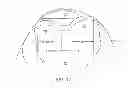 Fig. 28 - Systems and methods for providing deeper knee flexion capabilities for knee prosthesis patients