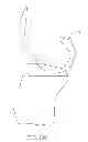 Fig. 33 - Systems and methods for providing deeper knee flexion capabilities for knee prosthesis patients