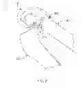 Fig. 40 - Systems and methods for providing deeper knee flexion capabilities for knee prosthesis patients