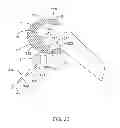 Fig. 41 - Systems and methods for providing deeper knee flexion capabilities for knee prosthesis patients