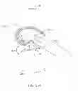 Fig. 44 - Systems and methods for providing deeper knee flexion capabilities for knee prosthesis patients