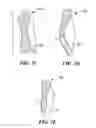 Fig. 05 - Patient selectable knee arthroplasty devices