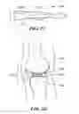 Fig. 06 - Patient selectable knee arthroplasty devices