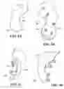 Fig. 16 - Patient selectable knee arthroplasty devices