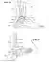 Fig. 03 - Ankle replacement system