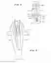 Fig. 04 - Ankle replacement system