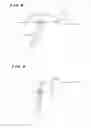Fig. 07 - Ankle replacement system