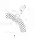 Fig. 02 - Interlocking acetabular fixation screws and their combination with a reverse hip acetabular cup