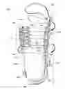 Fig. 01 - Adjustable socket system
