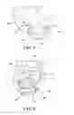 Fig. 04 - Adjustable socket system