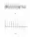 Fig. 02 - METHOD AND SYSTEM FOR OBTAINING CYCLE OF PHYSIOLOGICAL SIGNAL