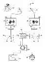Fig. 01 - Speech recognition with a plurality of microphones