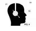 Fig. 05 - Low power activation of a voice activated device