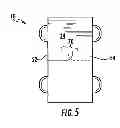 Fig. 06 - PATIENT POSITIONING DEVICE
