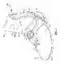 Fig. 02 - Ankle and foot support system