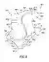 Fig. 09 - Ankle and foot support system