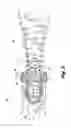Fig. 03 - Injectors for multipoint injection