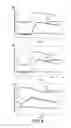 Fig. 08 - Method and Apparatus for Enhanced Flameholding in Augmentors