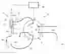 Fig. 01 - Methods for Injecting Samples in Liquid Chromatography, Particularly in High Performance Liquid Chromatography