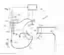 Fig. 06 - Methods for Injecting Samples in Liquid Chromatography, Particularly in High Performance Liquid Chromatography