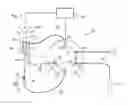 Fig. 08 - Methods for Injecting Samples in Liquid Chromatography, Particularly in High Performance Liquid Chromatography