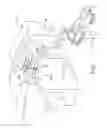 Fig. 02 - Automated steering centering assembly