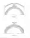 Fig. 06 - Welded Cuff