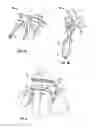 Fig. 03 - Mitter wringer