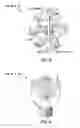 Fig. 04 - Active control of drill bit walking