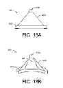 Fig. 17 - Acoustic isolation mechanism with membrane