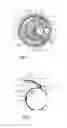 Fig. 02 - Needle Storage Magazine