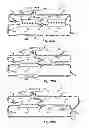 Fig. 15 - FLUID COMPONENT SEPARATION DEVICES, METHODS, AND SYSTEMS