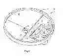 Fig. 05 - Double entry channel ladle bottom